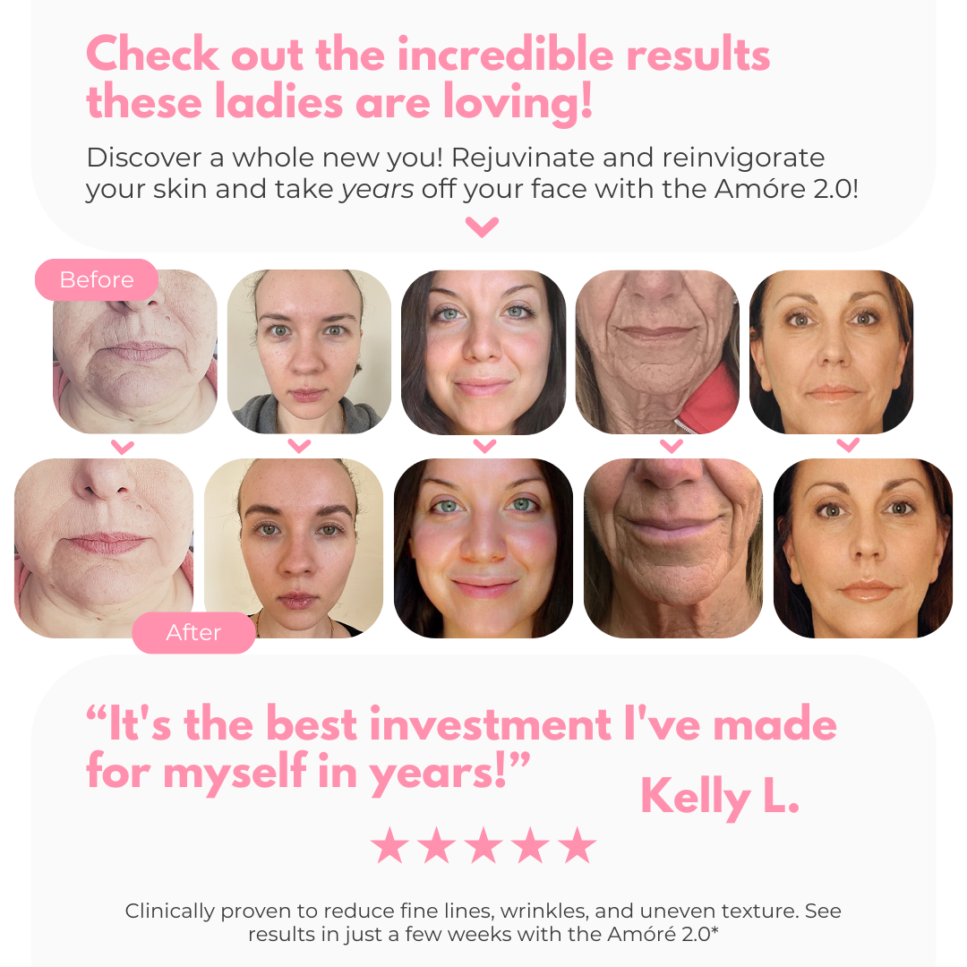 Check Out These Luovo Amore 2.0 At Home Anti-Aging Cosmetic Skincare Device Results! After Just Two Weeks! See results in just a few weeks! Clinically proven to reduce fine lines, wrinkles and uneven skin texture! Tighten skin and increase facial muscle elasticity!